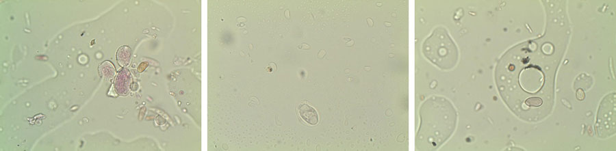 Tecnovino Viticast imágenes microscopio